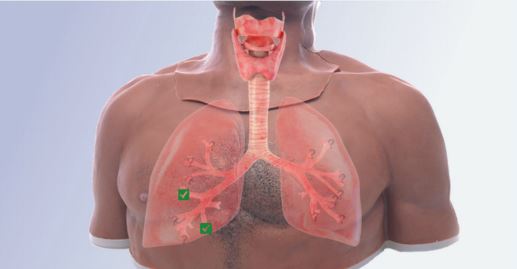 bronchi